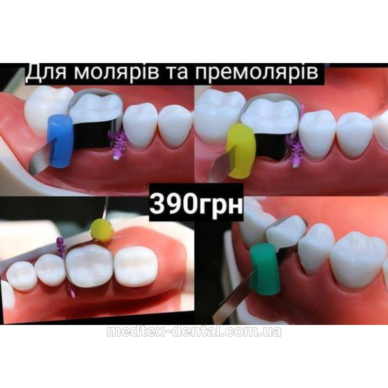 Кільце для секційних матриць 4 шт. аналог Palodent від МедТех