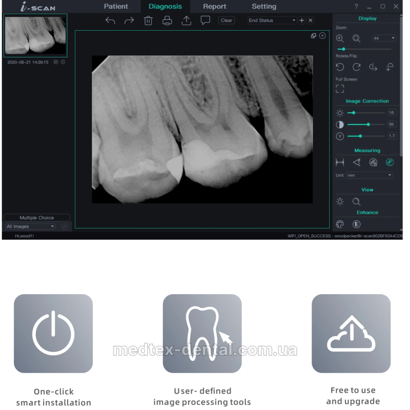 Візіограф i-Sensor H1.5, розмір 1.5